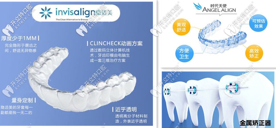 長(zhǎng)沙青橙口腔合作的矯正器含：隱適美、時(shí)代天使等