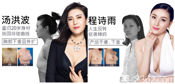 深圳美萊整形醫(yī)院梁志為隆胸案例對比圖