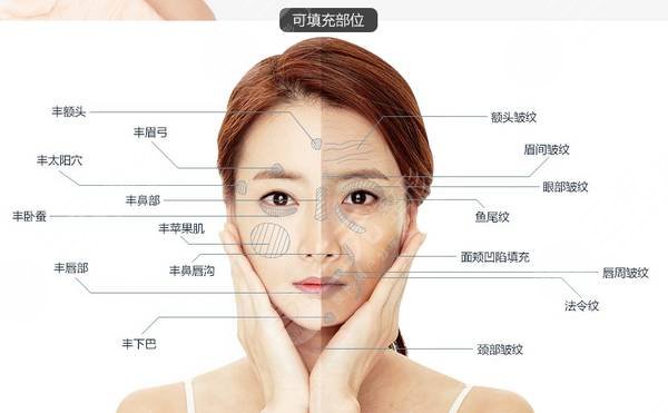 面部輪廓整形項(xiàng)目科普及費(fèi)用價(jià)格參考