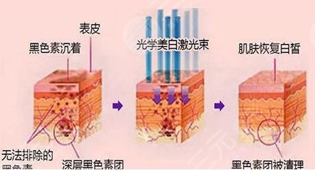 激光美容類項(xiàng)目科