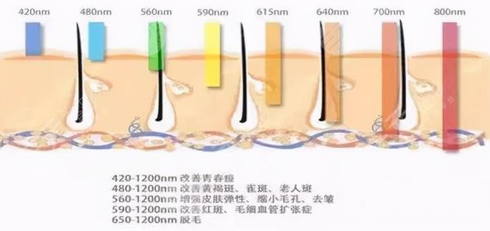 無錫二院光子嫩膚案例|恢復(fù)過程圖