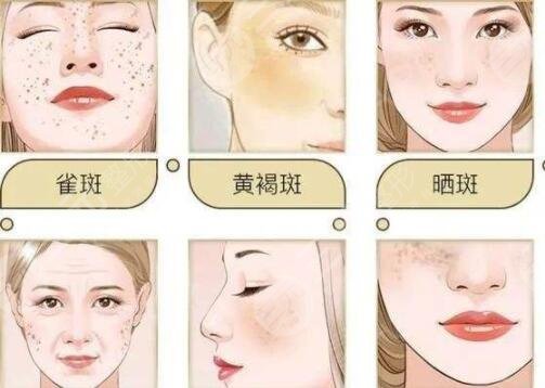 無錫二院祛斑真實(shí)案例