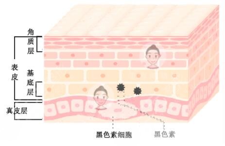 中山大學(xué)附屬第三醫(yī)院點(diǎn)陣激光祛斑案例