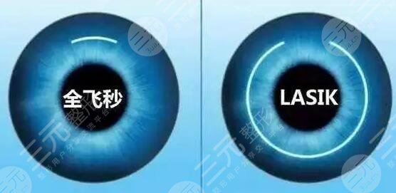 近視手術(shù)價格會受到選擇醫(yī)生的影響：