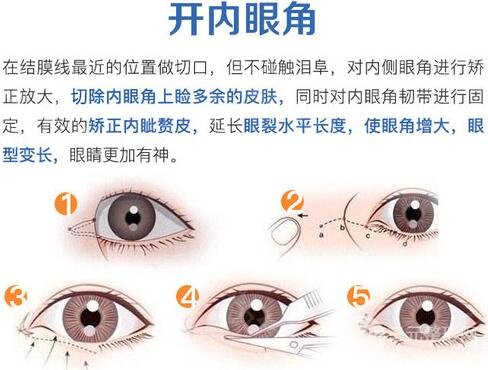 溫州附二院整形美容科眼部整形怎么樣
