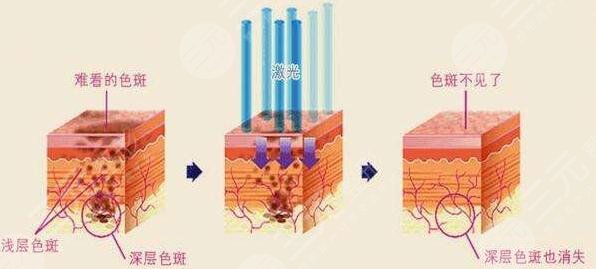 嘉興第三醫(yī)院美容科技術(shù)好不好