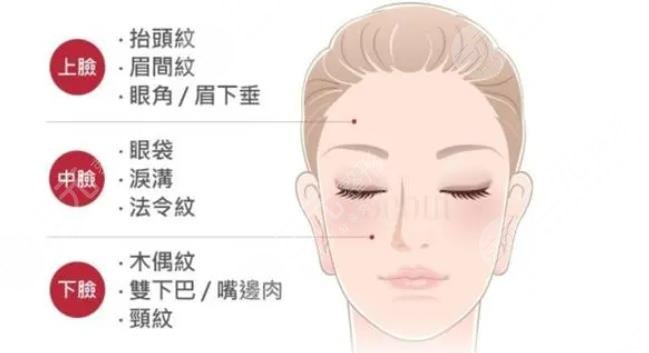 拉皮需要注意的問題