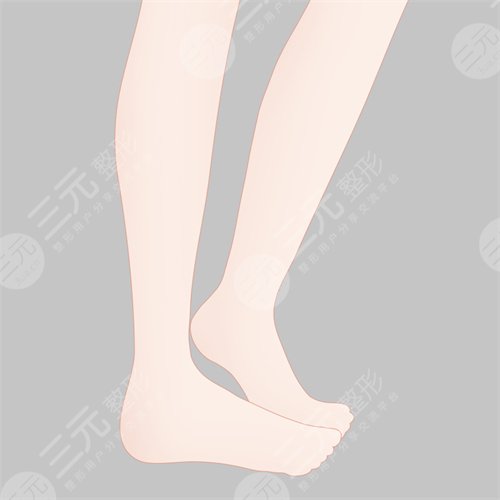 哈爾濱211醫(yī)院整形美容科大腿抽脂案例