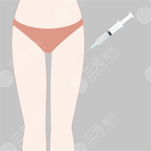 大腿吸脂術(shù)前