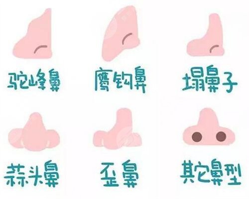 假體隆鼻整形手術(shù)過(guò)程