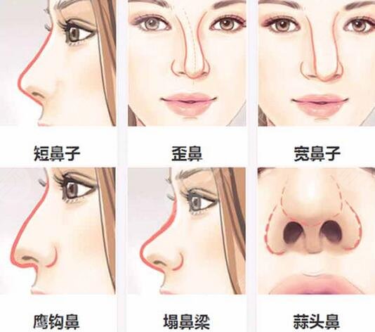 南京皮膚研究所整形美容科價(jià)格表更新，附醫(yī)生介紹+整形案例~