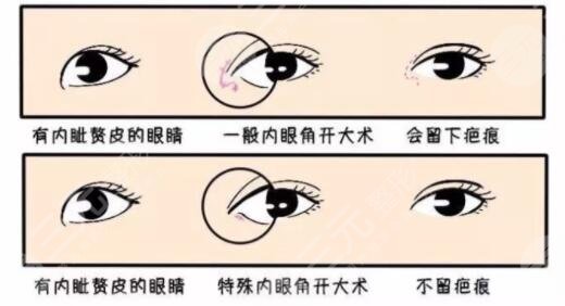 開眼角
