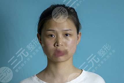 哈爾濱211美容科整形嶄新價(jià)目表來襲！跟我一起來揭秘這家醫(yī)院吧