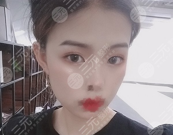 哈爾濱211美容科整形嶄新價(jià)目表來襲！跟我一起來揭秘這家醫(yī)院吧