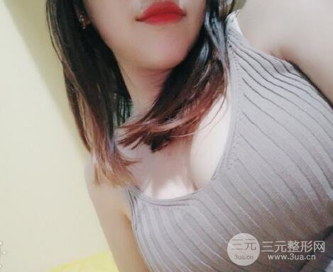 自體脂肪填充乳房