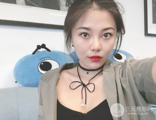 面部拉皮除皺