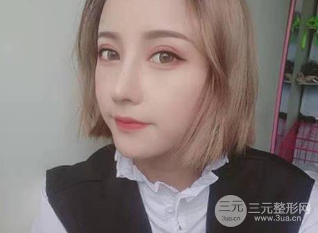 徐州二院整形科價格表更新&醫(yī)生名單&隆鼻案例~