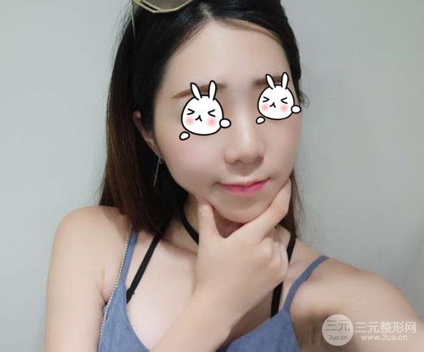 徐州二院整形科價格表更新&醫(yī)生名單&隆鼻案例~