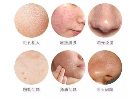 嘉興榮軍醫(yī)院皮膚科激光美容價(jià)格表
