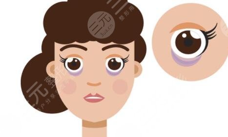 泉州180醫(yī)院整形祛眼袋案例，科室價(jià)格表更新！