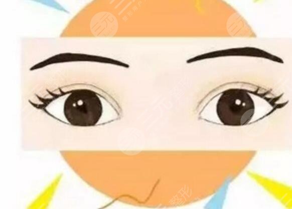 全切雙眼皮案例對(duì)比圖