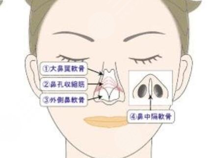 長(zhǎng)春朗妍假體隆鼻前后恢復(fù)過(guò)程對(duì)比圖