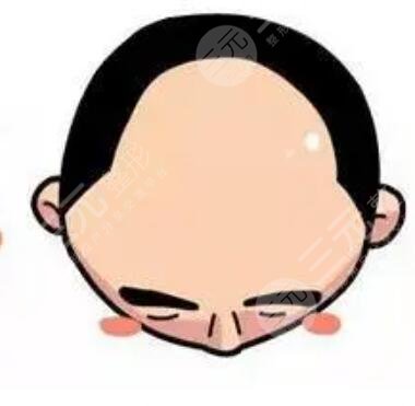 廈門碧蓮盛植發(fā)醫(yī)院醫(yī)生介紹