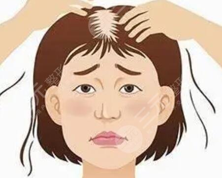 蘭州雍禾植發(fā)醫(yī)院發(fā)際線改善案例